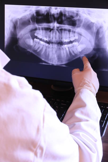 Best Emergency Tooth Extraction in Winooski, VT